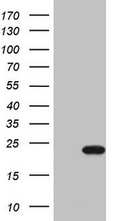 CDKN1A / WAF1 / p21 Antibody - HEK293T cells were transfected with the pCMV6-ENTRY control (Left lane) or pCMV6-ENTRY CDKN1A (Right lane) cDNA for 48 hrs and lysed. Equivalent amounts of cell lysates (5 ug per lane) were separated by SDS-PAGE and immunoblotted with anti-CDKN1A (1:2000).