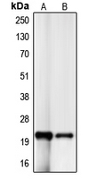 CDKN1A / WAF1 / p21 Antibody - Western blot analysis of p21 expression in HeLa (A); HT1080 (B) whole cell lysates.