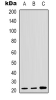 CDKN1A / WAF1 / p21 Antibody - Western blot analysis of p21 expression in MCF7 (A); HUVEC (B); Raw264.7 (C) whole cell lysates.