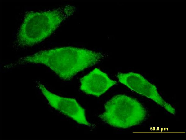 CDKN1A / WAF1 / p21 Antibody - Immunofluorescence of monoclonal antibody to CDKN1A on HeLa cell . [antibody concentration 10 ug/ml]