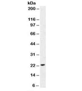 CDKN1A / WAF1 / p21 Antibody - Western blot testing of human MCF7 cell lysate with p21 antibody (clone DCS-60.2).