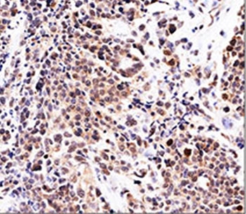 CDKN1A / WAF1 / p21 Antibody - p21 antibody WA-1 immunohistochemistry.  This image was taken for the unmodified form of this product. Other forms have not been tested.