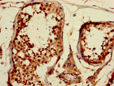 CDKN1A / WAF1 / p21 Antibody - IHC image of Rabbit anti-Human Cyclin-dependent kinase inhibitor 1 polyclonal Antibody diluted at 1:1200 and staining in paraffin-embedded human testis tissue performed on a Leica BondTM system. After dewaxing and hydration, antigen retrieval was mediated by high pressure in a citrate buffer (pH 6.0). Section was blocked with 10% normal goat serum 30min at RT. Then primary antibody (1% BSA) was incubated at 4°C overnight. The primary is detected by a biotinylated secondary antibody and visualized using an HRP conjugated SP system.