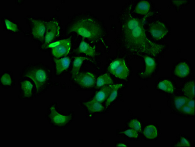 CDKN1A / WAF1 / p21 Antibody - Immunofluorescence staining of MCF-7 cells with Rabbit anti-Human Cyclin-dependent kinase inhibitor 1 polyclonal Antibody at 1:400, counter-stained with DAPI. The cells were fixed in 4% formaldehyde, permeabilized using 0.2% Triton X-100 and blocked in 10% normal Goat Serum. The cells were then incubated with the antibody overnight at 4°C. The secondary antibody was Alexa Fluor 488-congugated AffiniPure Goat Anti-Rabbit IgG(H+L).