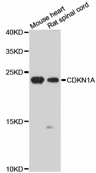 CDKN1A / WAF1 / p21 Antibody - Western blot analysis of extracts of various cell lines, using CDKN1A antibody at 1:1000 dilution. The secondary antibody used was an HRP Goat Anti-Rabbit IgG (H+L) at 1:10000 dilution. Lysates were loaded 25ug per lane and 3% nonfat dry milk in TBST was used for blocking. An ECL Kit was used for detection and the exposure time was 90s.