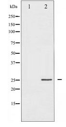 CDKN1A / WAF1 / p21 Antibody - Western blot of p21 Cip1 expression in EGF treated HeLa whole cell lysates,The lane on the left is treated with the antigen-specific peptide.