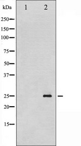 CDKN1A / WAF1 / p21 Antibody - Western blot analysis of p21 Cip1 phosphorylation expression in EGF treated HeLa whole cells lysates. The lane on the left is treated with the antigen-specific peptide.