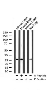 CDKN1A / WAF1 / p21 Antibody - Western blot analysis of extracts of various cells lines using OCT3 antibody.