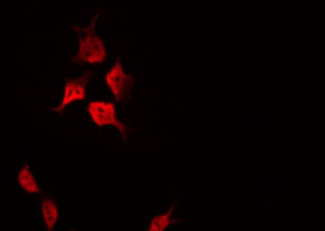 CDKN1A / WAF1 / p21 Antibody - Staining HeLa cells by IF/ICC. The samples were fixed with PFA and permeabilized in 0.1% Triton X-100, then blocked in 10% serum for 45 min at 25°C. The primary antibody was diluted at 1:200 and incubated with the sample for 1 hour at 37°C. An Alexa Fluor 594 conjugated goat anti-rabbit IgG (H+L) Ab, diluted at 1/600, was used as the secondary antibody.