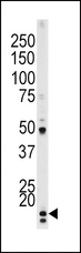 CDKN1A / WAF1 / p21 Antibody - The anti-Phospho-P21CIP1-T145 antibody is used in Western blot to detect Phospho-P21CIP1-T145 in HeLa tissue lysate.