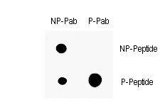 CDKN1A / WAF1 / p21 Antibody - Dot blot of anti-Phospho-P21CIP1-T145 Antibody on nitrocellulose membrane. 50ng of Phospho-peptide or Non Phospho-peptide per dot were adsorbed. Antibodies working concentration was 0.5ug per ml.