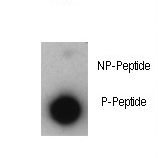 CDKN1A / WAF1 / p21 Antibody - Dot blot of anti-Phospho-P21CIP1-T57 Antibody on nitrocellulose membrane. 50ng of Phospho-peptide or Non Phospho-peptide per dot were adsorbed. Antibody working concentrations are 0.5ug per ml.