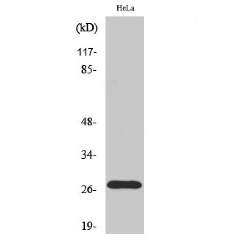 CDKN1B / p27 Kip1 Antibody - Western blot of Phospho-p27 (T187) antibody
