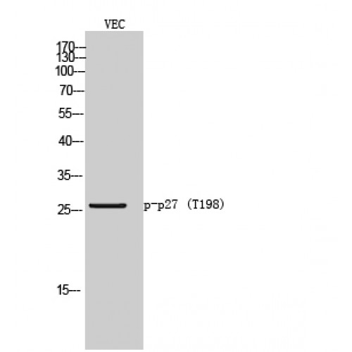 CDKN1B / p27 Kip1 Antibody - Western blot of Phospho-p27 (T198) antibody