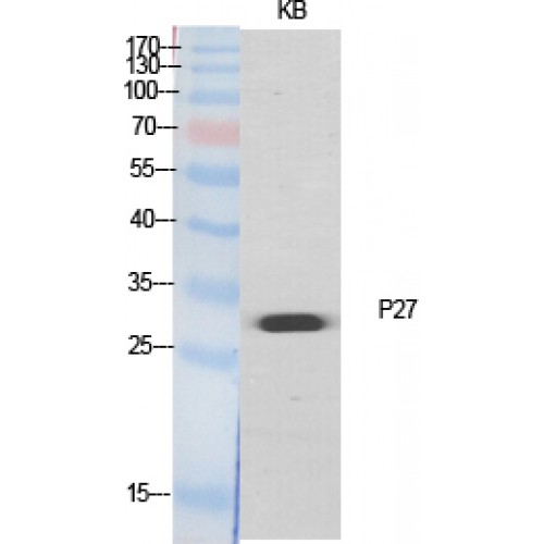 CDKN1B / p27 Kip1 Antibody - Western blot of p27 antibody