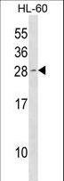 CDKN1B / p27 Kip1 Antibody - Mouse Cdkn1b Antibody western blot of HL-60 cell line lysates (35 ug/lane). The Mouse Cdkn1b antibody detected the Mouse Cdkn1b protein (arrow).
