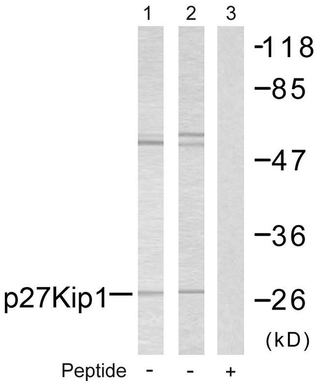 CDKN1B / p27 Kip1 Antibody - Western blot analysis of lysates from A2780 cells, using p27 Kip1 Antibody. The lane on the right is blocked with the synthesized peptide.