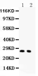 CDKN1B / p27 Kip1 Antibody - P27 KIP 1 antibody Western blot. All lanes: Anti-p27 KIP 1 at 0.5 ug/ml. Lane 1: Rat Thymus Tissue Lysate at 40 ug. Lane 2: Rat Brain Tissue Lysate at 40 ug. Predicted band size: 27 kD. Observed band size: 27 kD.