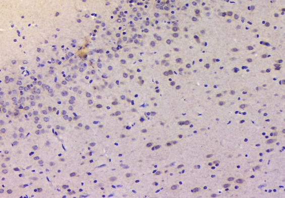 CDKN1B / p27 Kip1 Antibody - IHC analysis of p27 KIP 1 using anti-p27 KIP 1 antibody. p27 KIP 1 was detected in paraffin-embedded section of rat brain tissues. Heat mediated antigen retrieval was performed in citrate buffer (pH6, epitope retrieval solution) for 20 mins. The tissue section was blocked with 10% goat serum. The tissue section was then incubated with 1µg/ml rabbit anti-p27 KIP 1 Antibody overnight at 4°C. Biotinylated goat anti-rabbit IgG was used as secondary antibody and incubated for 30 minutes at 37°C. The tissue section was developed using Strepavidin-Biotin-Complex (SABC) with DAB as the chromogen.