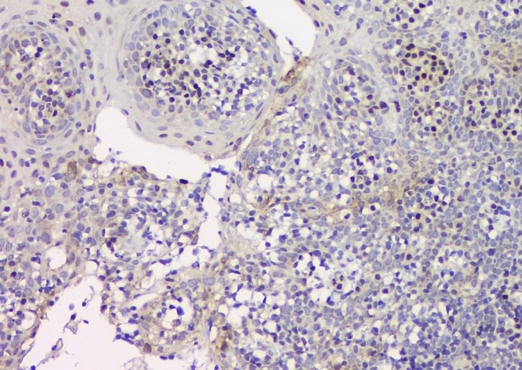 CDKN1B / p27 Kip1 Antibody - IHC analysis of p27 KIP 1 using anti-p27 KIP 1 antibody. p27 KIP 1 was detected in paraffin-embedded section of human tonsil tissues. Heat mediated antigen retrieval was performed in citrate buffer (pH6, epitope retrieval solution) for 20 mins. The tissue section was blocked with 10% goat serum. The tissue section was then incubated with 1µg/ml rabbit anti-p27 KIP 1 Antibody overnight at 4°C. Biotinylated goat anti-rabbit IgG was used as secondary antibody and incubated for 30 minutes at 37°C. The tissue section was developed using Strepavidin-Biotin-Complex (SABC) with DAB as the chromogen.