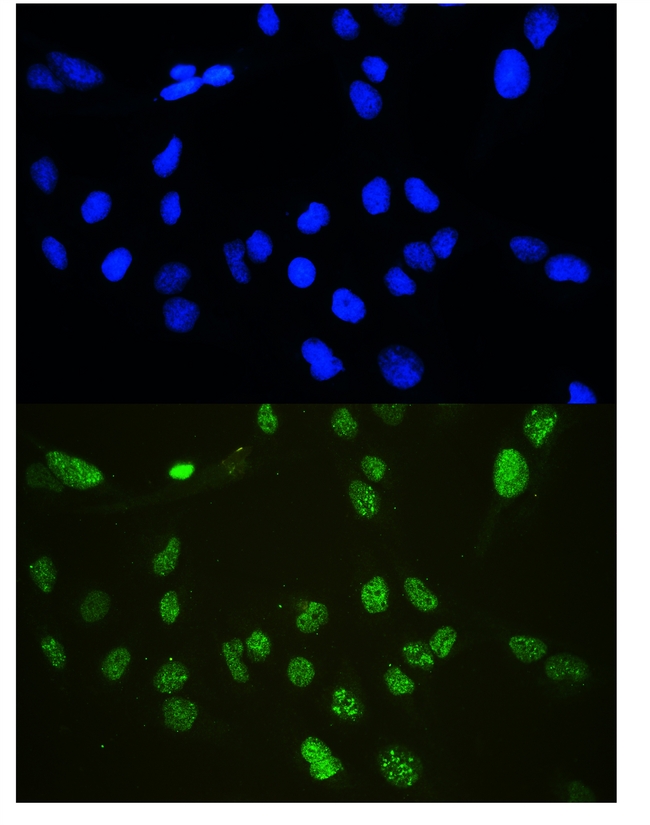CDKN1B / p27 Kip1 Antibody - IF analysis of p27 KIP 1 using anti-p27 KIP 1 antibody p27 KIP 1 was detected in immunocytochemical section of U20S cells. Enzyme antigen retrieval was performed using IHC enzyme antigen retrieval reagent for 15 mins. The tissue section was blocked with 10% goat serum. The tissue section was then incubated with 2µg/mL rabbit anti-p27 KIP 1 Antibody overnight at 4°C. DyLight®488 Conjugated Goat Anti-Rabbit IgG was used as secondary antibody at 1:100 dilution and incubated for 30 minutes at 37°C. The section was counterstained with DAPI. Visualize using a fluorescence microscope and filter sets appropriate for the label used.
