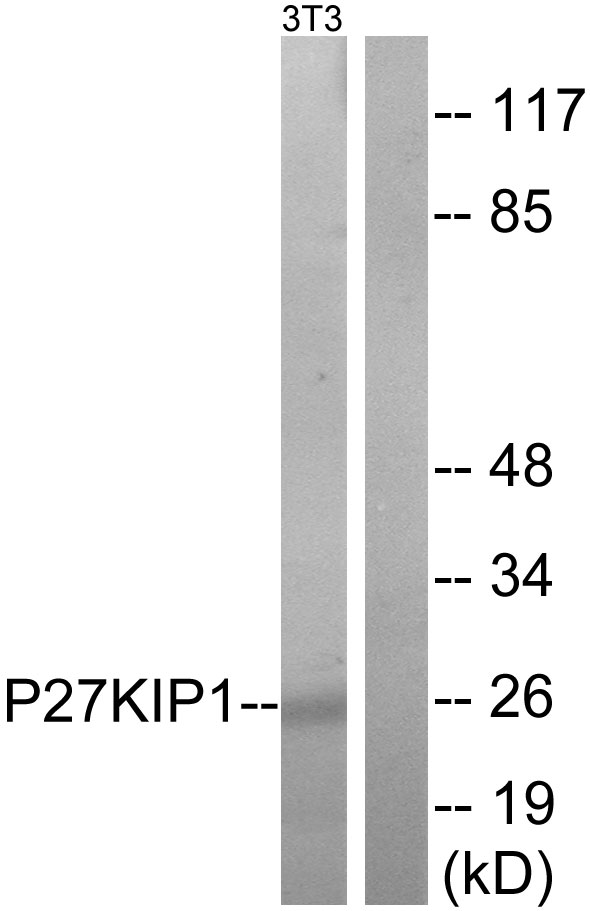 CDKN1B / p27 Kip1 Antibody - Western blot analysis of lysates from NIH and 3T3 cells, treated with EGF, using p27 Kip1 Antibody. The lane on the right is blocked with the synthesized peptide.