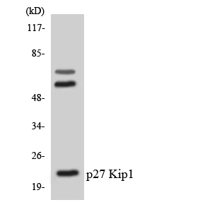 CDKN1B / p27 Kip1 Antibody - Western blot analysis of the lysates from Jurkat cells using p27 Kip1 antibody.