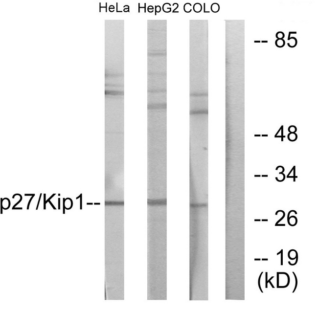 CDKN1B / p27 Kip1 Antibody - Western blot analysis of lysates from HeLa, HepG2, and COLO205 cells, using p27 Kip1 Antibody. The lane on the right is blocked with the synthesized peptide.