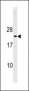 CDKN1B / p27 Kip1 Antibody - Mouse p27Kip1 Antibody (C-term T197) western blot of mouse heart tissue lysates (35 ug/lane). The (mouse) p27Kip1 antibody detected the (mouse) p27Kip1 protein (arrow).
