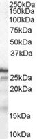 CDKN1B / p27 Kip1 Antibody - CDKN1B antibody (1 ug/ml) staining of Human Breast lysate (35 ug protein/ml in RIPA buffer). Primary incubation was 1 hour. Detected by chemiluminescence.