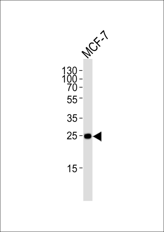 CDKN1B / p27 Kip1 Antibody - Western blot of lysate from MCF-7 cell line with CDKN1B-Y88. Antibody was diluted at 1:1000. A goat anti-rabbit IgG H&L (HRP) at 1:5000 dilution was used as the secondary antibody. Lysate at 35 ug.