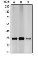 CDKN1B / p27 Kip1 Antibody - Western blot analysis of p27 Kip1 expression in MCF7 (A); HEK293T (B); PC12 (C) whole cell lysates.