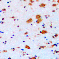 CDKN1B / p27 Kip1 Antibody - Immunohistochemical analysis of p27 Kip1 staining in human brain formalin fixed paraffin embedded tissue section. The section was pre-treated using heat mediated antigen retrieval with sodium citrate buffer (pH 6.0). The section was then incubated with the antibody at room temperature and detected using an HRP conjugated compact polymer system. DAB was used as the chromogen. The section was then counterstained with hematoxylin and mounted with DPX.
