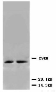 CDKN1B / p27 Kip1 Antibody -  This image was taken for the unconjugated form of this product. Other forms have not been tested.