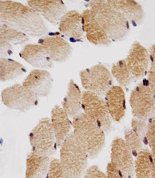 CDKN1B / p27 Kip1 Antibody - Immunohistochemical of paraffin-embedded H. skeletal muscle section using CDKN1B Antibody. Antibody was diluted at 1:25 dilution. A peroxidase-conjugated goat anti-rabbit IgG at 1:400 dilution was used as the secondary antibody, followed by DAB staining.