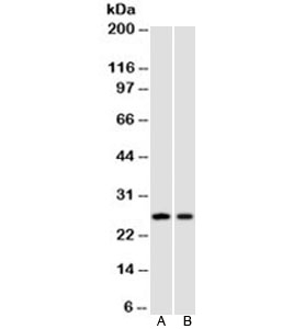 CDKN1B / p27 Kip1 Antibody - Western blot testing of A) HeLa and B) Jurkat cell lysate using p27Kip1 antibody (clone SPM348). This image was taken for the unmodified form of this product. Other forms have not been tested.