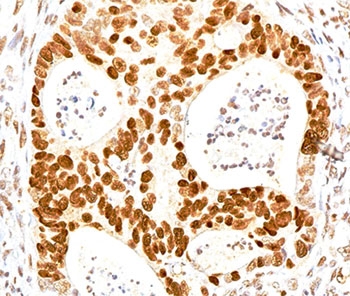 CDKN1B / p27 Kip1 Antibody - p27Kip1 antibody SX53G8 immunohistochemistry.  This image was taken for the unmodified form of this product. Other forms have not been tested.