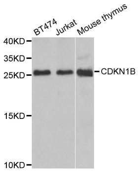 CDKN1B / p27 Kip1 Antibody - Western blot analysis of extracts of various cell lines.