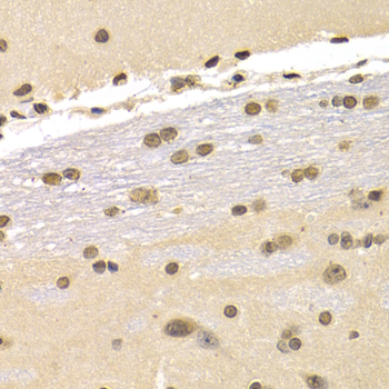 CDKN1B / p27 Kip1 Antibody - Immunohistochemistry of paraffin-embedded rat brain tissue.