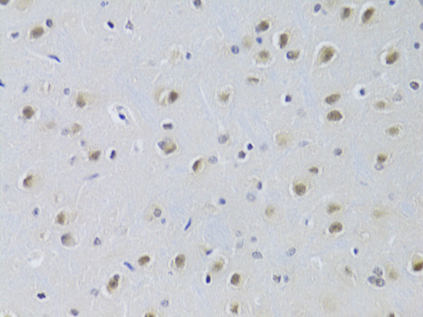 CDKN1B / p27 Kip1 Antibody - Immunohistochemistry of paraffin-embedded rat brain using CDKN1B Antibodyat dilution of 1:100 (40x lens).