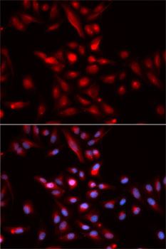 CDKN1B / p27 Kip1 Antibody - Immunofluorescence analysis of HeLa cells using CDKN1B antibody. Blue: DAPI for nuclear staining.