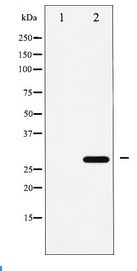 CDKN1B / p27 Kip1 Antibody - Western blot of p27 Kip1 expression in EGF treated HeLa whole cell lysates,The lane on the left is treated with the antigen-specific peptide.