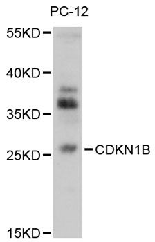 CDKN1B / p27 Kip1 Antibody - Western blot analysis of extracts of PC-12 cells, using CDKN1B antibody at 1:1000 dilution. The secondary antibody used was an HRP Goat Anti-Rabbit IgG (H+L) at 1:10000 dilution. Lysates were loaded 25ug per lane and 3% nonfat dry milk in TBST was used for blocking. An ECL Kit was used for detection and the exposure time was 90s.