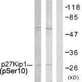 CDKN1B / p27 Kip1 Antibody - Western blot analysis of lysates from A2780 and COLO205 cells, using p27 Kip1 (Phospho-Ser10) Antibody. The lane on the right is blocked with the phospho peptide.