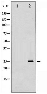 CDKN1B / p27 Kip1 Antibody - Western blot of p27 Kip1 phosphorylation expression in A2780 whole cell lysates,The lane on the left is treated with the antigen-specific peptide.