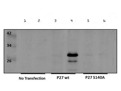 CDKN1B / p27 Kip1 Antibody - Western Blot of Rabbit anti-p27kip1pS140 Antibody. Lane 1: 293 cells untransfected. Lane 2: 293 cells untransfected and treated. Lane 3: 293 cells transfected with HA-p27wt. Lane 4: 293 cells transfected with HA-p27wt and treated. Lane 5: 293 cells transfected with HA-p27S140A. Lane 6: 293 cells transfected with HA-p27S140A and treated. Load: 20 µg per lane. Primary antibody: p27kip1pS140 antibody at 1:250 for overnight at 4°C. Secondary antibody: IRDye800™ rabbit secondary antibody at 1:10,000 for 45 min at RT.