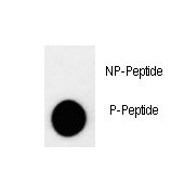 CDKN1B / p27 Kip1 Antibody - Dot blot of anti-p27Kip1-T157 Phospho-specific antibody on nitrocellulose membrane. 50ng of Phospho-peptide or Non Phospho-peptide per dot were adsorbed. Antibody working concentrations are 0.6ug per ml.