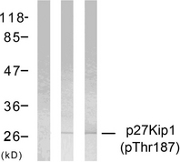 CDKN1B / p27 Kip1 Antibody - Western blot analysis of lysates from HeLa cells treated with EGF or IFN-Î±, using p27 Kip1 (Phospho-Thr187) Antibody. The lane on the left is blocked with the phospho peptide.