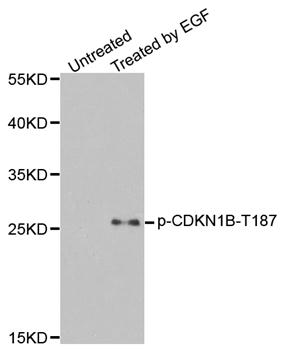 CDKN1B / p27 Kip1 Antibody - Western blot analysis of extracts from HeLa cells.
