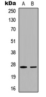 CDKN1B / p27 Kip1 Antibody - Western blot analysis of p27 Kip1 (pT187) expression in HeLa (A); MCF7 (B) whole cell lysates.